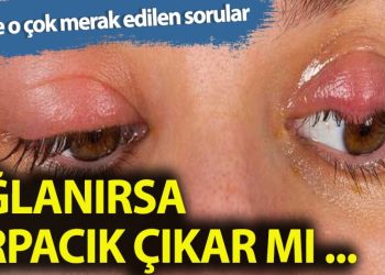İşte arpacığın bilinmeyenleri